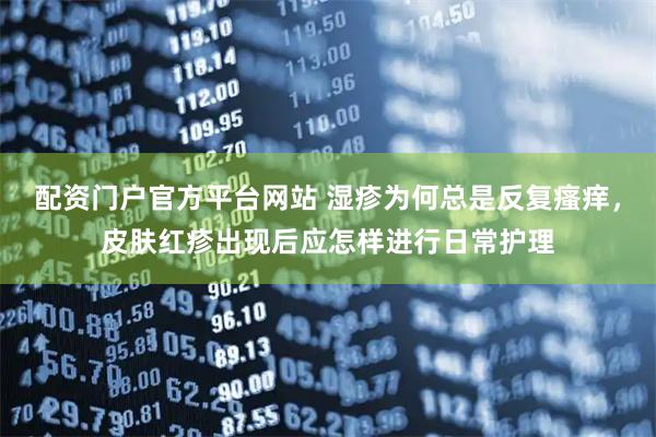 配资门户官方平台网站 湿疹为何总是反复瘙痒，皮肤红疹出现后应怎样进行日常护理